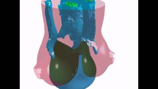 LSDYNA R7 Strong FSI coupling  Heart Valve Opening and closing [upl. by Eive]