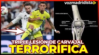 MUCHO PEOR DE LO ESPERADOLA LESIÓN DE CARVAJAL [upl. by Ennairak284]