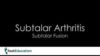 FootEd Subtalar Arthritis Subtalar Fusion [upl. by Diella]