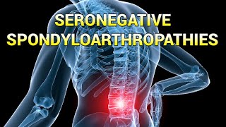 Seronegative Spondyloarthropathies updated 2023  CRASH Medical Review Series [upl. by Placia]