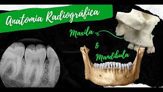 O que podemos ver em uma radiografia Anatomia Radiográfica [upl. by Adnat]