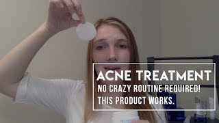 Acne Treatment That Works Review of ZO Skin Health Complexion Renewal Pads [upl. by Merp185]