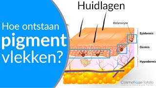 PIGMENTVLEKKEN  Hoe ontstaan pigmentvlekken  Wat zijn pigmentvlekken [upl. by Latoya458]