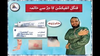 Lamisil Cream uses in urdu  Terbinafine Hydrochloride cream  How to treat Fungal Infection Review [upl. by Estrellita276]