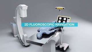 Brainlab Fluoro 2D Registration and Navigation [upl. by Ailiec]