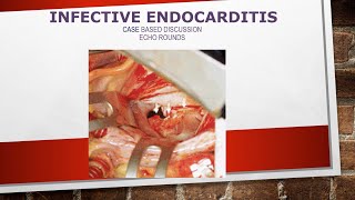 Echocardiography in infective endocarditis Casebased discussions [upl. by Marchese]