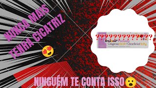 VLOG POMADA IRUXOL  colagenase e cloranfenicol [upl. by Hanan]