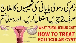 How To Treat Follicular Cyst  Reham ki Rasoli Ka Ilaj  Pani ki Thelion Ka Ilaj [upl. by Gentry]