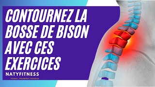 Contournez La Bosse de Bison Avec ces Exercices  Améliorer Votre Posture [upl. by Carilyn825]