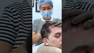 Cara Clinic Hair PRP Treatment Everything You Need to Know [upl. by Anomis]