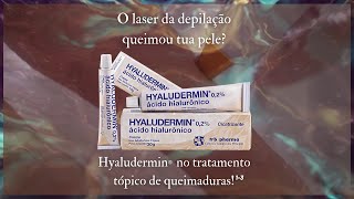 HYALUDERMIN  O laser da depilação queimou tua pele [upl. by Nilak]