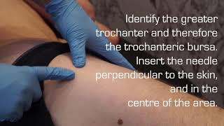 Injection Technique of the Trochanteric Bursa for Bursitis [upl. by Anaimad]