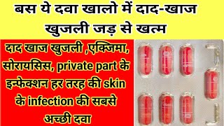 बस ये दवा खा लो दादखाज खुजली जड से खत्महर तरह के skin Infection की दवाIntraconazol tablet used [upl. by Wollis105]