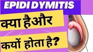 Epididymitis क्या है और क्यों होता है [upl. by Isaiah]