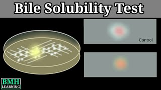 Bile Solubility Test  Streptococcus Pneumoniae Biochemical Test [upl. by Vardon950]