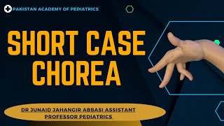 Short Case Chorea  Teaching on Patient [upl. by Gosnell516]