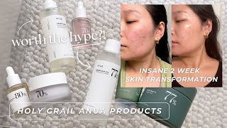 my holy grail korean skincare for calming acne amp healing my skin barrier  ANUA product review [upl. by Enirok902]