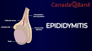 Epididymitis [upl. by Leotie]