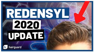 Redensyl 2020 Updates For YOUR Hair GROWTH [upl. by Sillek638]