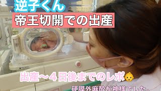 逆子👶予定帝王切開出産レポ！！！ [upl. by Amaryllis]