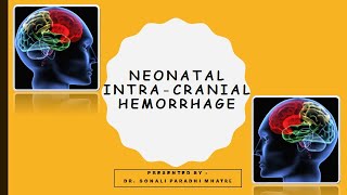 Neonatal Intracranial bleed including Intraventricular Hemorrhage IVH [upl. by Lukin]