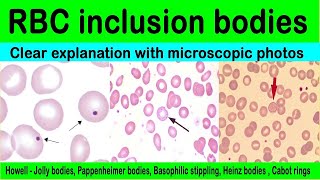 Thin film comment part 3 Red blood Cell Inclusion Bodies made easy  Hematology [upl. by Ancel172]