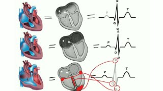 ECG de A à Z  la physiologie cardiaque prt 3 la conduction electrique du coeur [upl. by Nossah]