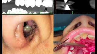 Etiology of Malocclusion المرحلة الخامسة [upl. by Anisamot]