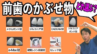 【前歯のかぶせ物７選】長持ちする歯、美しい歯はどれ？ おすすめ治療法を歯医者が解説 [upl. by Llednahs263]