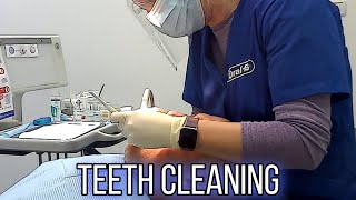 Teeth cleaning in the dental clinic scaling polish teeth [upl. by Charteris906]