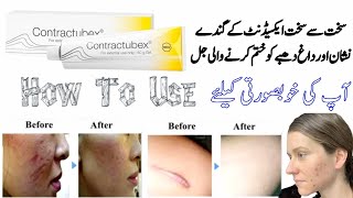 contractubex  contractubex gel  contractubex gel how to use  contractubex gel for acne scars [upl. by Mulcahy]