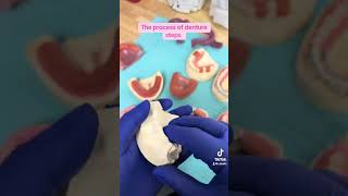 The process of denture steps dental dentalhygiene dentalassistant [upl. by Latin]