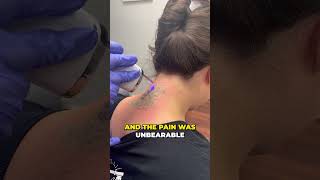 The Most Satisfying Tattoo Removal 😳 [upl. by Einahets837]