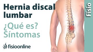 Hernia discal o de disco lumbar  Qué es causas síntomas y tratamiento [upl. by Gasser617]