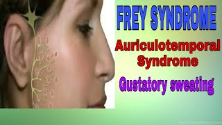 Frey Syndrome  Auriculotemporal Syndrome  Gustatory Sweating  dental Maestro  DrJyoti Agarwal [upl. by Cullan]