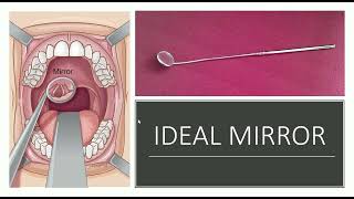 INDIRECT LARYNGOSCOPY MIRROR IN ENT [upl. by Forcier]