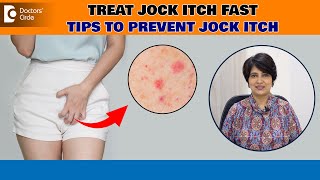 Jock Itch Tinea Cruris Best ways to avoid Itching Down There  Dr Rasya Dixit Doctors Circle [upl. by Alleinnad]