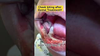 Cheek biting after Dental Treatment [upl. by Akenot]