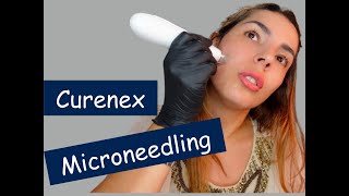 Micronnedling Curenex le combo Parfait pour une peau éclatante élimine les taches BrunoDermalFiller [upl. by Eetnod]