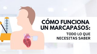 Cómo funciona un Marcapasos [upl. by Jezrdna]