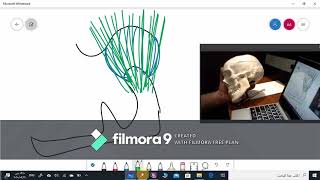 Mandibular movements and mandibular axes [upl. by Aronal]