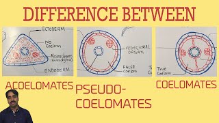 Acoelomates Pseudocoelomates and coelomates  Triploblastic organisation [upl. by Aneeh]