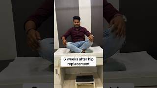 Recovery time in MIS Hip replacement totalhipreplacementsurgery shortsindia [upl. by Eemaj62]