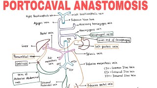 PORTOCAVAL ANASTOMOSIS  PORTOSYSTEMIC COMMUNICATIONS [upl. by Stultz438]