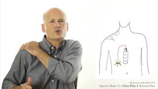 Chest Pain 3 Referred pain [upl. by Matthus735]