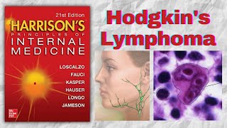 HODGKINS LYMPHOMA  Presentation  Diagnosis  Staging  Treatment  Harrison [upl. by Scholem]