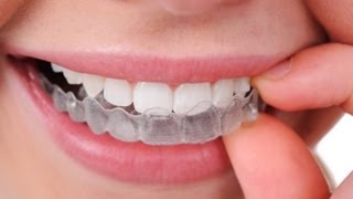 Ortodoncia invisible Inicia INVISALIGN [upl. by Amaso714]