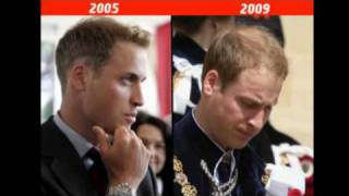 Prince Williams beauty before  after Kate in pictures [upl. by Esinet977]