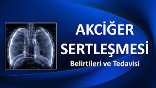 AKCİĞER SERTLEŞMESİ Belirtileri ve Tedavisi [upl. by Eugilegna]