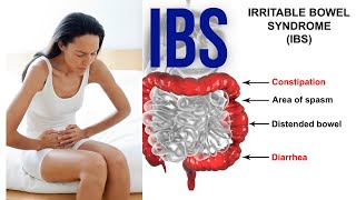 IBS symptoms  Irritable bowel syndrome symptoms  5 Symptoms of IBS [upl. by Kelcy]